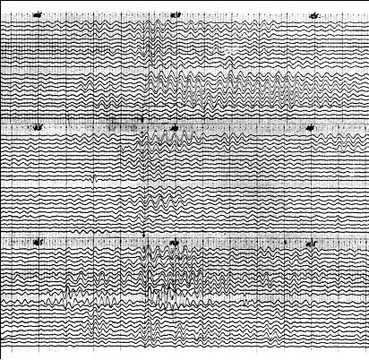 Seismic reflections at about 11 seconds